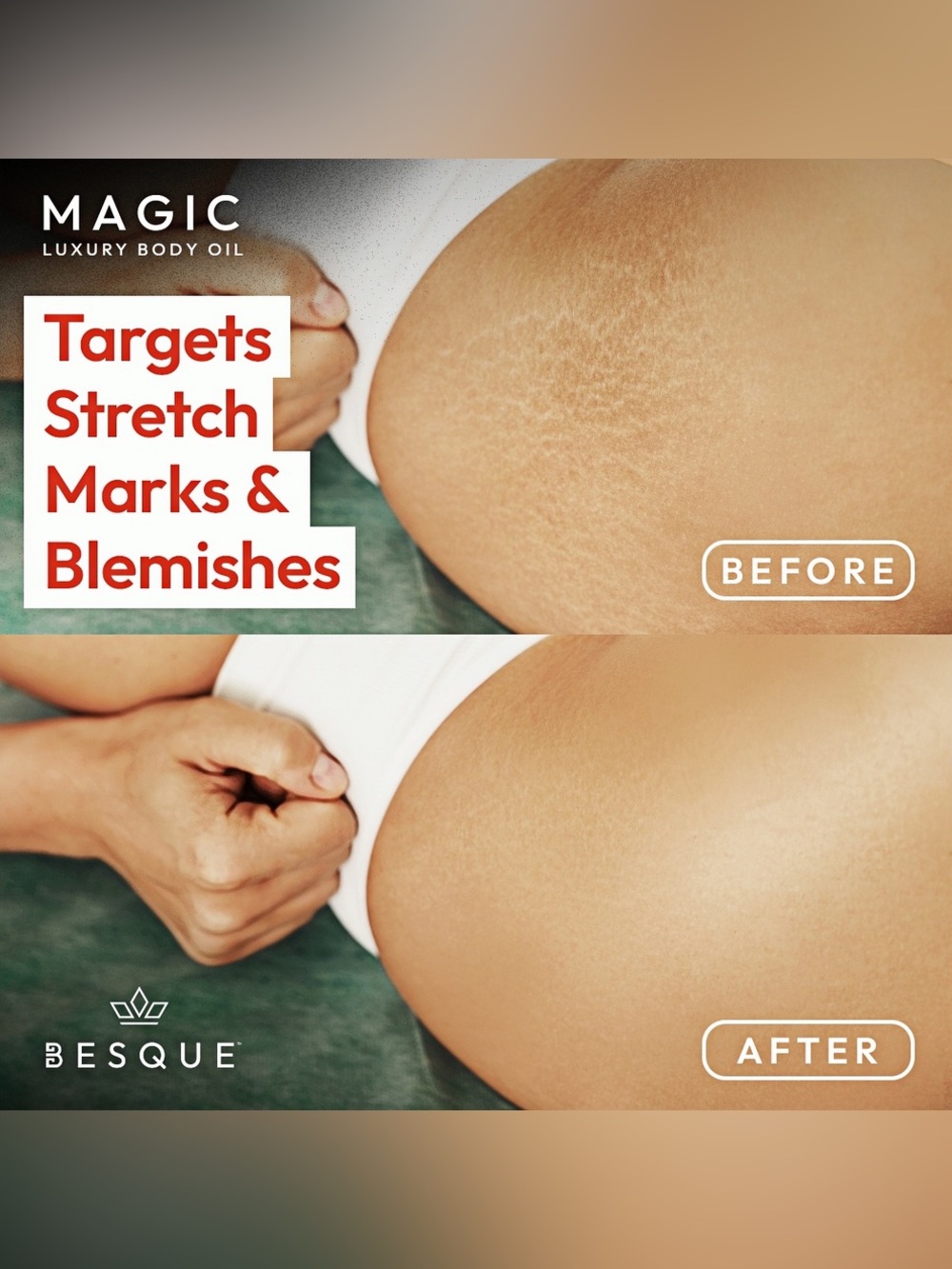 Besque Magic Luxury Body Oil (100 mL) - Picture 4 of 5